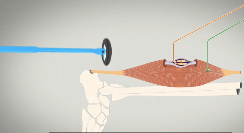 Le réflexe myotatique, qu&rsquo;es&nbsp;aquò?